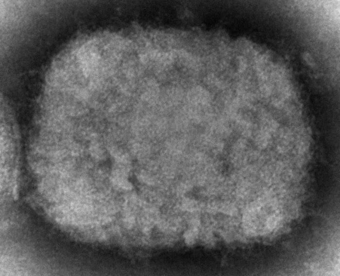 Is monkeypox being spread through sex?